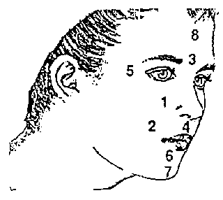 acute sinusitis purple face